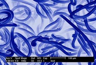 Jessica Bickel, 3rd Place - Digitally Enhanced or Colorized Images of Microstructures